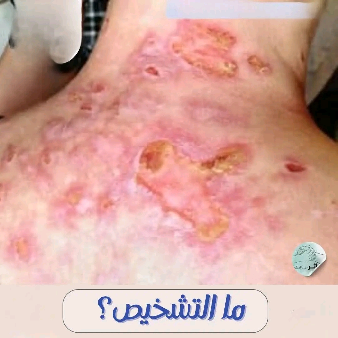 كيف تم تشخيص تلك الحالة: الاعراض وكيفية التعامل معها